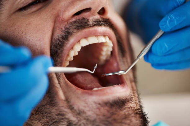 Best Weekend Emergency Dentist in Jamestown, ND